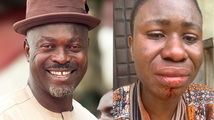 Lady Accuses Ahoada-West LG Chairman of Assault over Alarm She Raised on Condition of Dilapidated School