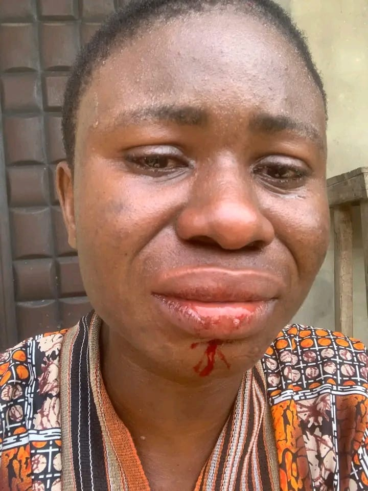 Rivers GBV Response Team, Demands Arrest Prosecution Ahoada-West LGA Chairman, Brother, Aides For Brutalization Of Ms Winnie Uchechi